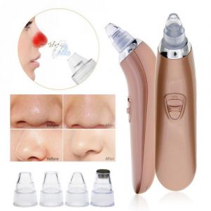 Aparat Za Ciscenje Pora i Mitisera NOVO 5