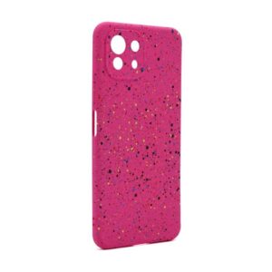 Futrola Spotty za Xiaomi Mi 11 Lite pink